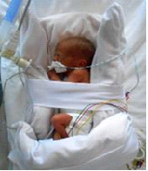 Image of support positioning of baby