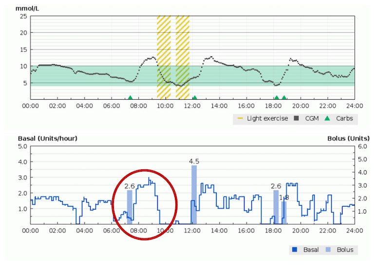 Diasend screenshot showing automated insulin delivery after a meal.