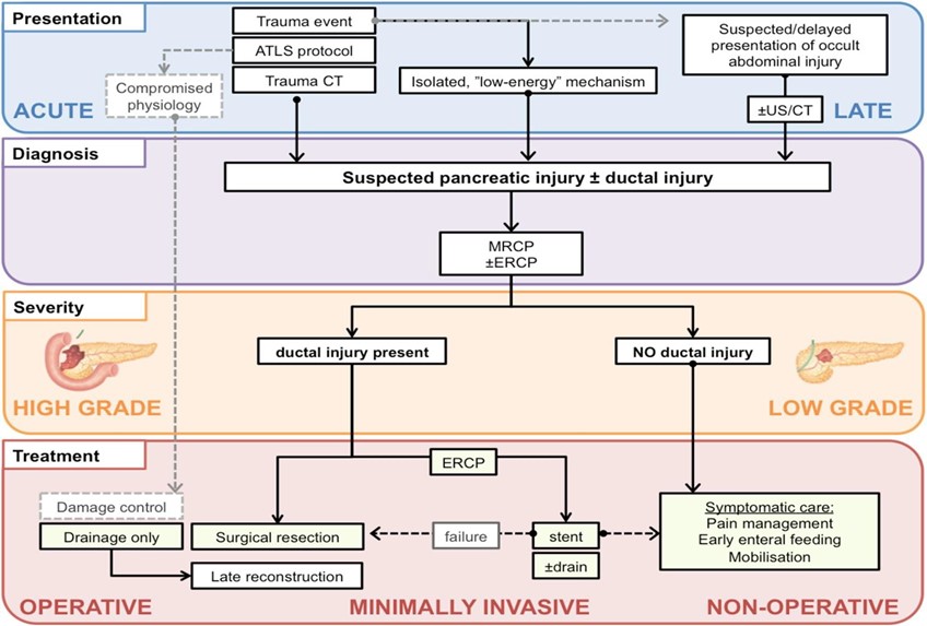 Pancreatic trauma algorithm